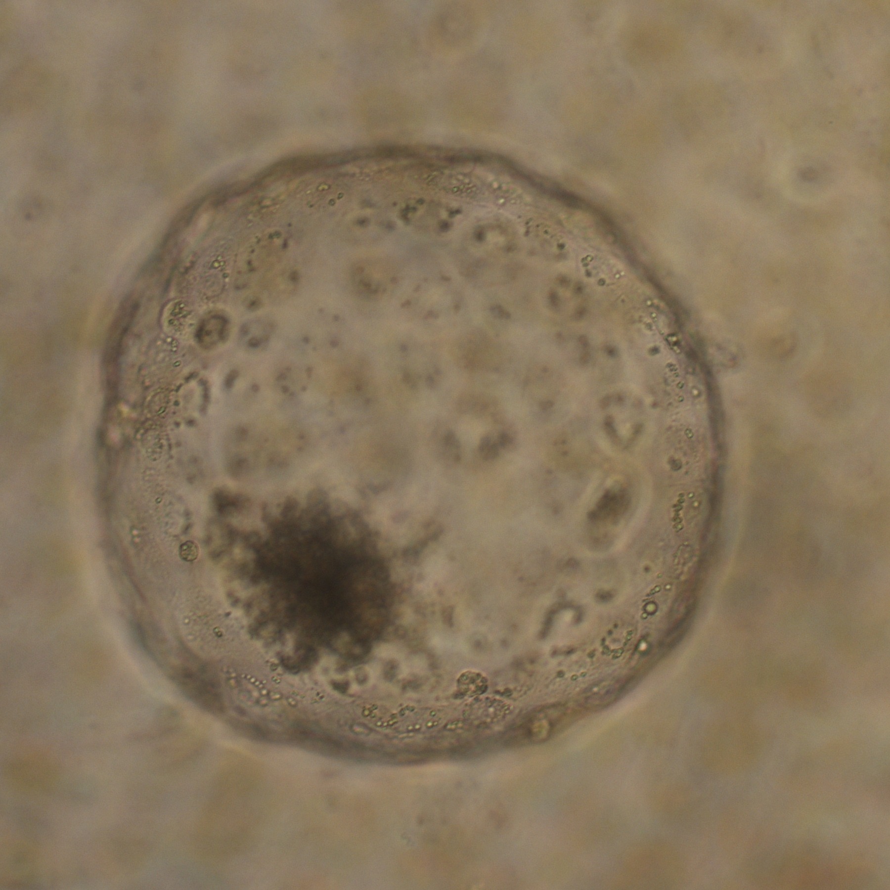 Blastocyst embryo viewed under the microscope before transfer