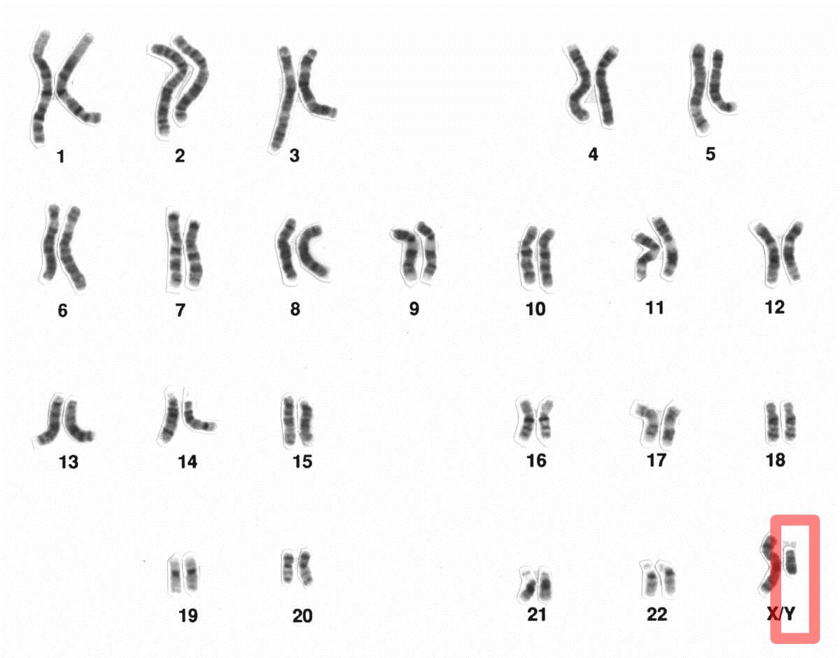 Karyotype analysis with Y-chromosome highlighted for genetic screening