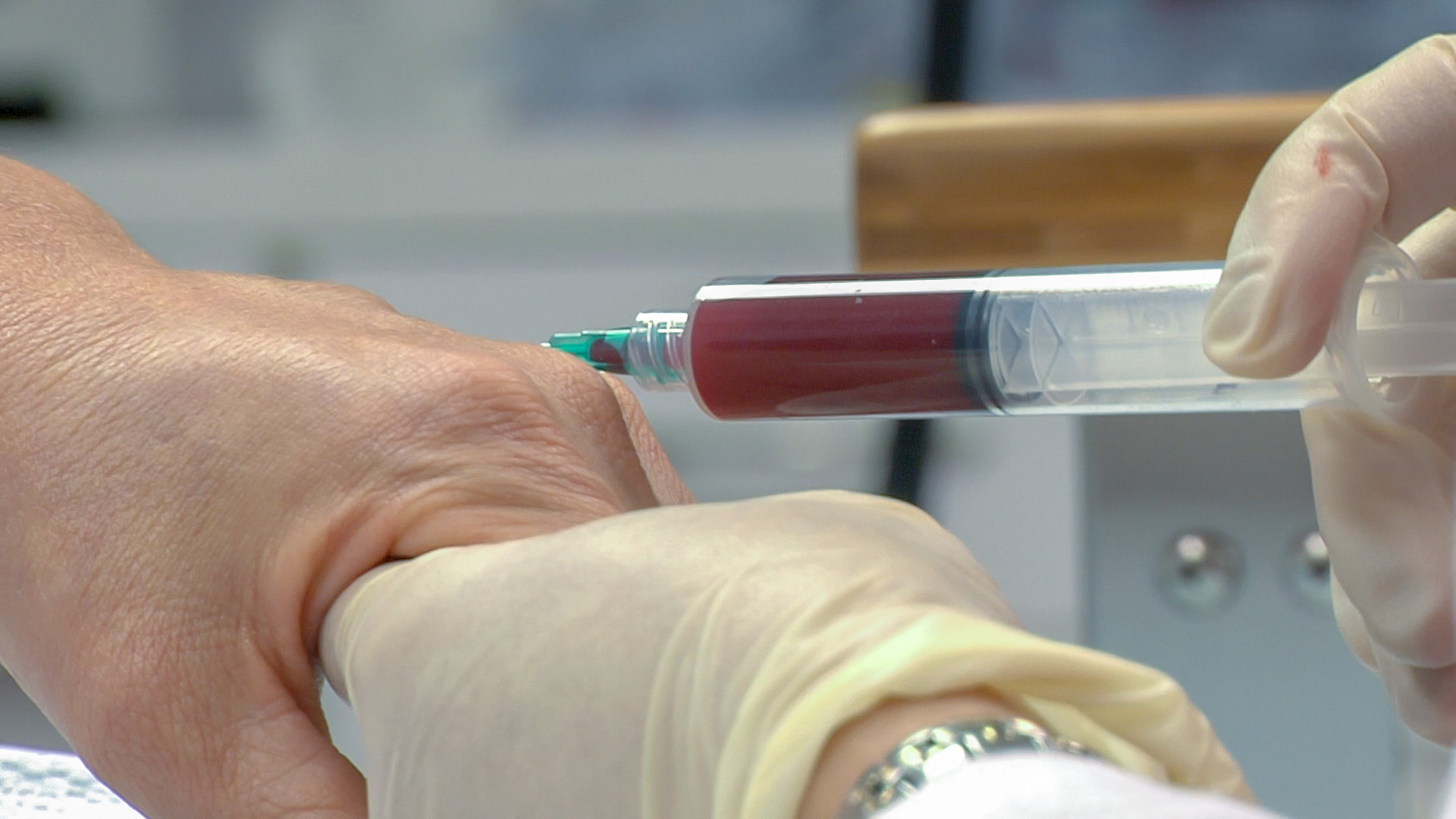 PRP therapy sample preparation in the lab